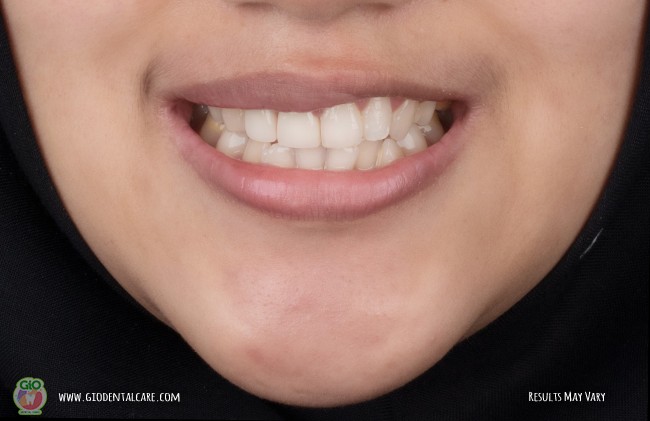 get-your-smile-here--1